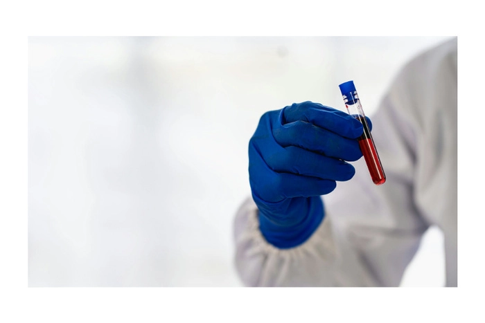 印尼启动全国免费健康检查计划  目标5年覆盖2.8亿人口 印尼启动全国免费健康检查计划  目标5年覆盖2.8亿人口